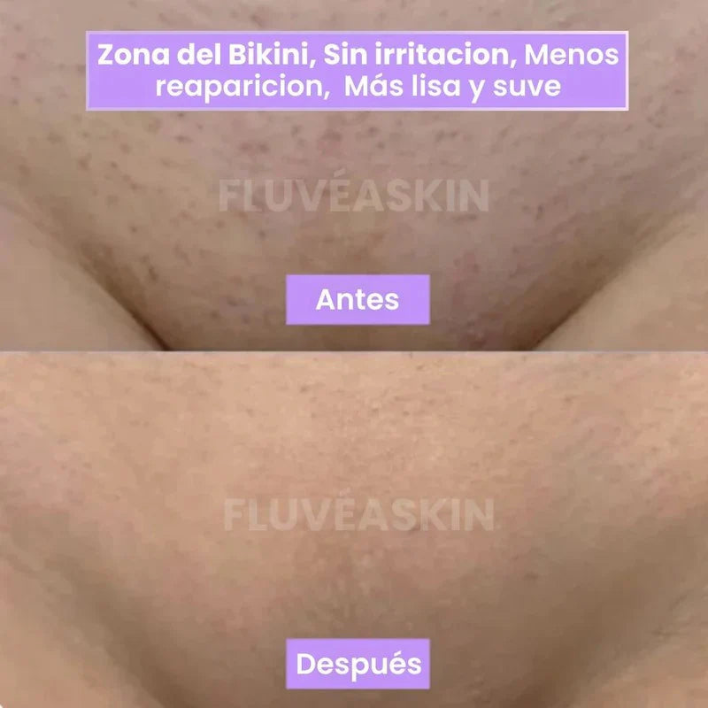 Piel de Seda - Inhibidor de Vello Cyperus