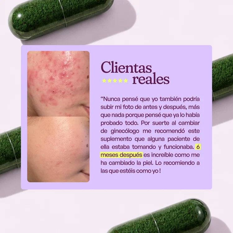A CONTROL - ACNÉ HORMONAL & RESISTENCIA A LA INSULINA