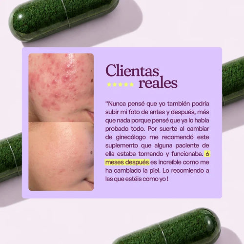 A CONTROL - ACNÉ HORMONAL & RESISTENCIA A LA INSULINA