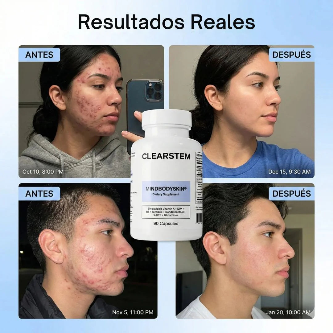 MINDBODYSKIN® Piel clara desde adentro