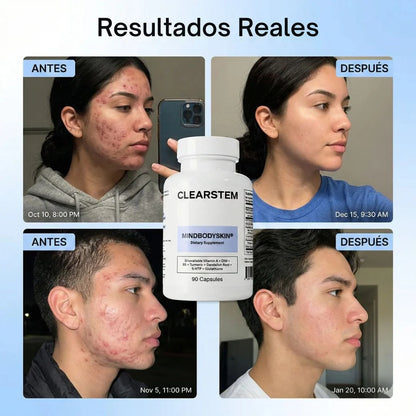 MINDBODYSKIN® Piel clara desde adentro