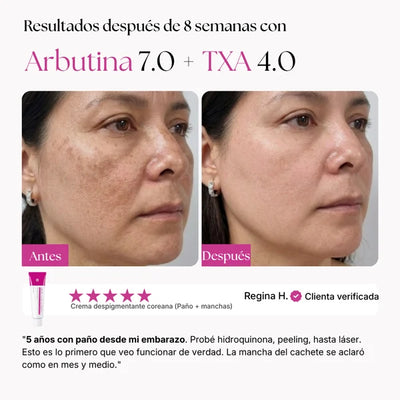 AmalNur Anti-Paño — Contra las Manchas que Siempre Vuelven