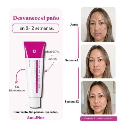 AmalNur Anti-Paño — Contra las Manchas que Siempre Vuelven