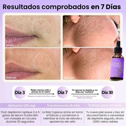 Piel de Seda - Inhibidor de Vello Cyperus