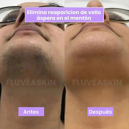 Piel de Seda - Inhibidor de Vello Cyperus
