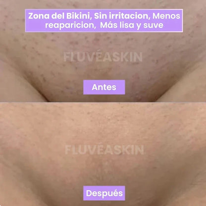 Piel de Seda - Inhibidor de Vello Cyperus
