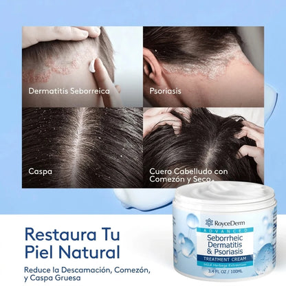 RoyceDerm – Crema para Dermatitis Seborreica y Psoriasis